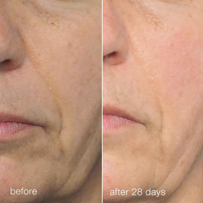 liquid peelfoliant
