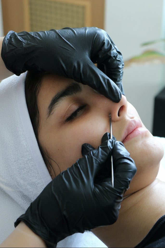 Acne Treatment Facial