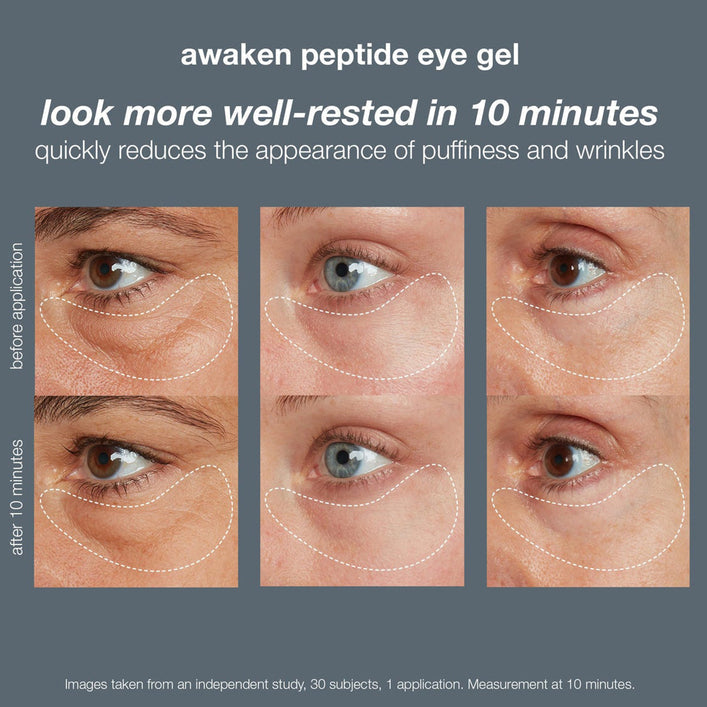 awaken peptide eye gel