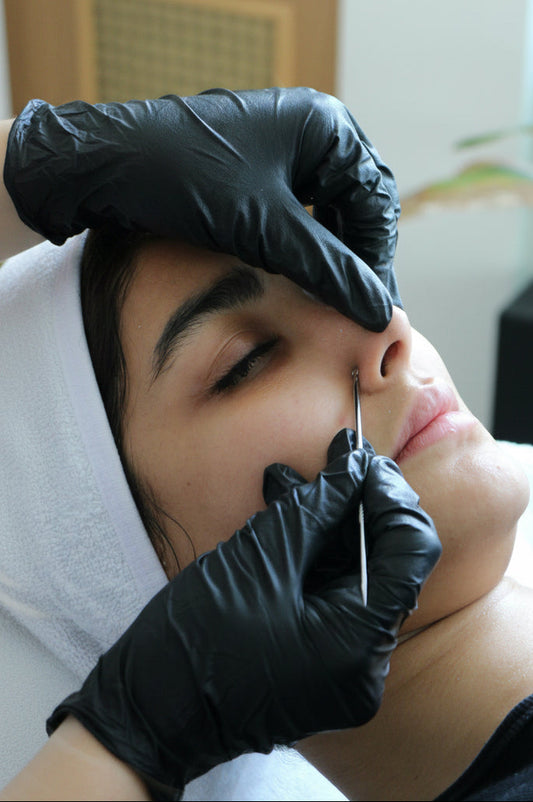 Acne Treatment Facial